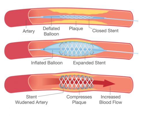 Our Cardiovascular Surgery Services & Procedures 