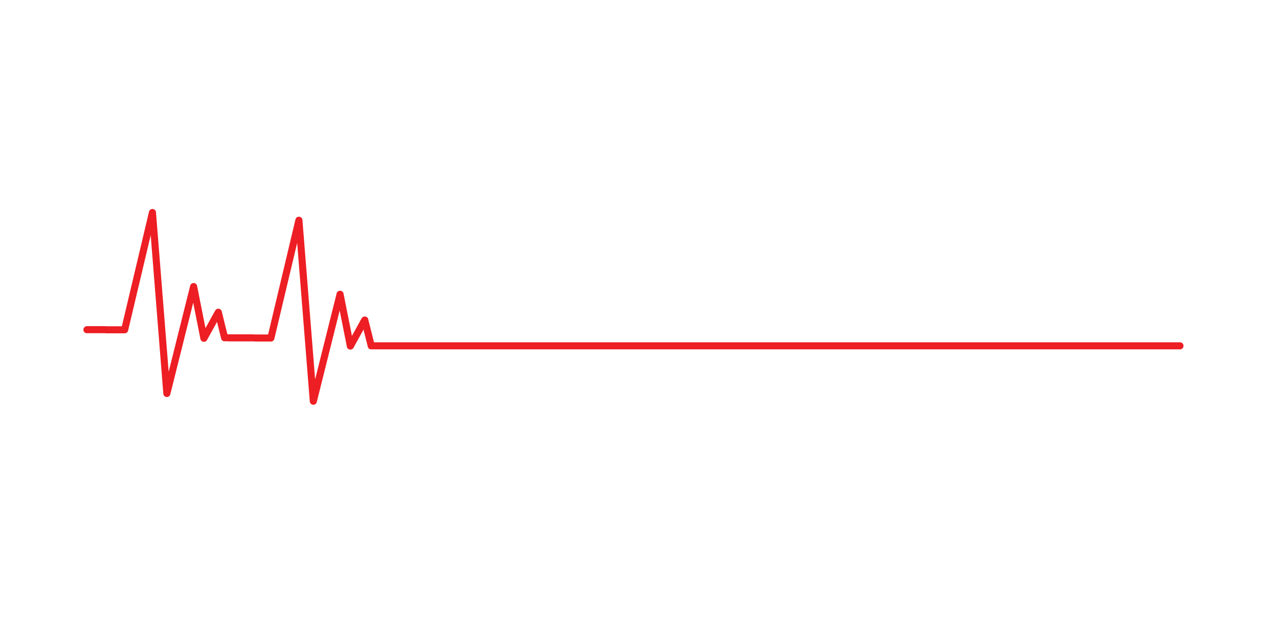 ekg line - ctvsurgeons